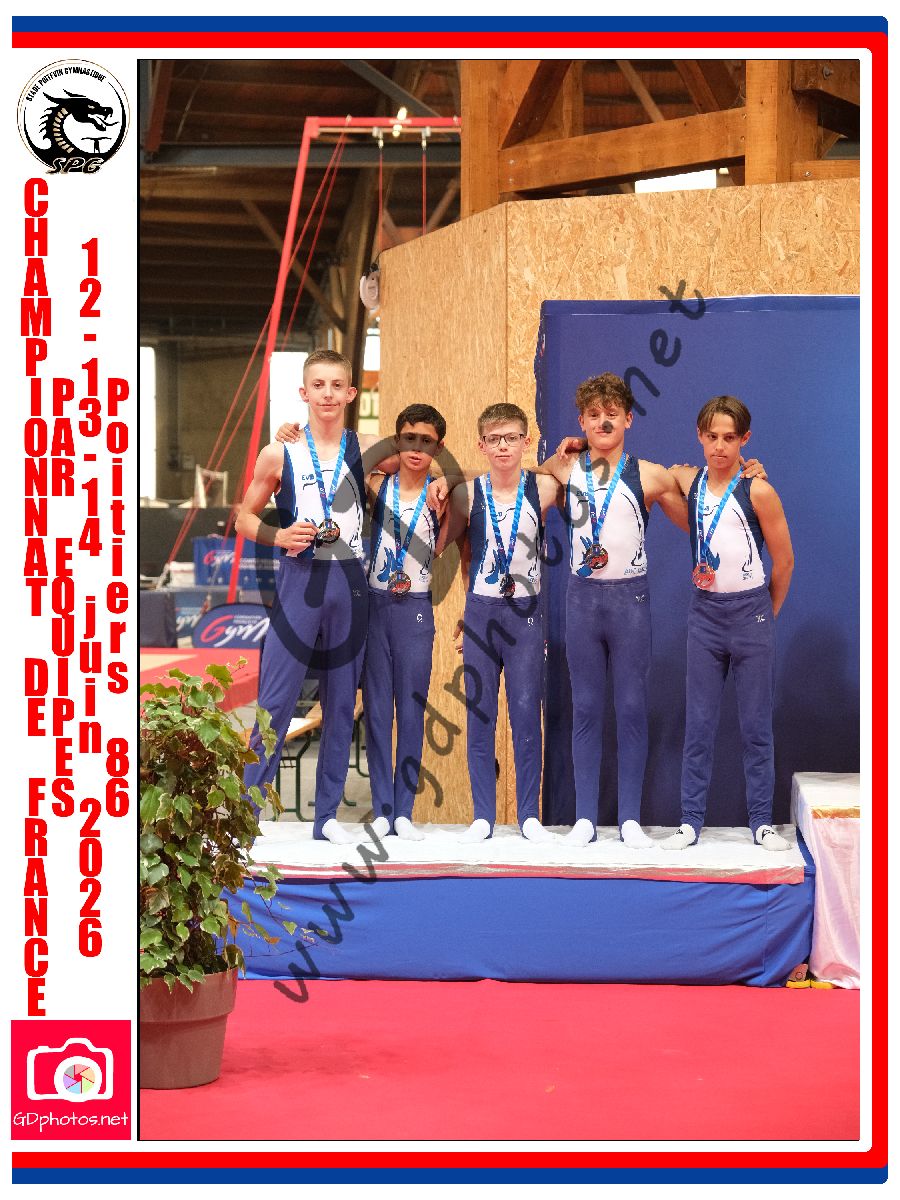 5424170
